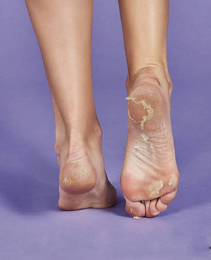 IROHA Glycolic Acid Peeling & Exfoliation Socks - Image 5